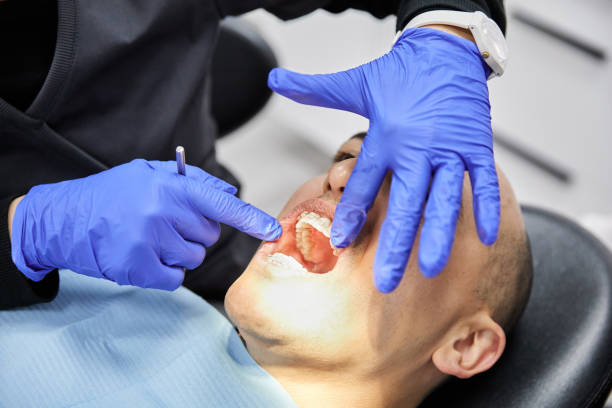 Best Emergency Dental Extractions in Deshler, OH