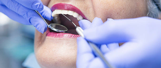 Best Emergency Dental Services for Seniors in Deshler, OH